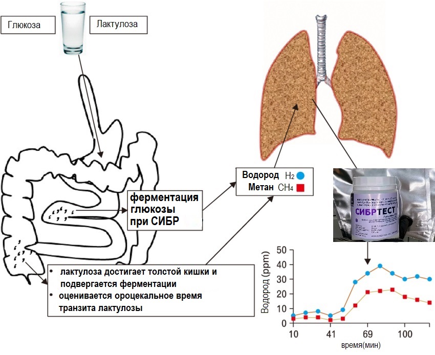 СИБР инфографика